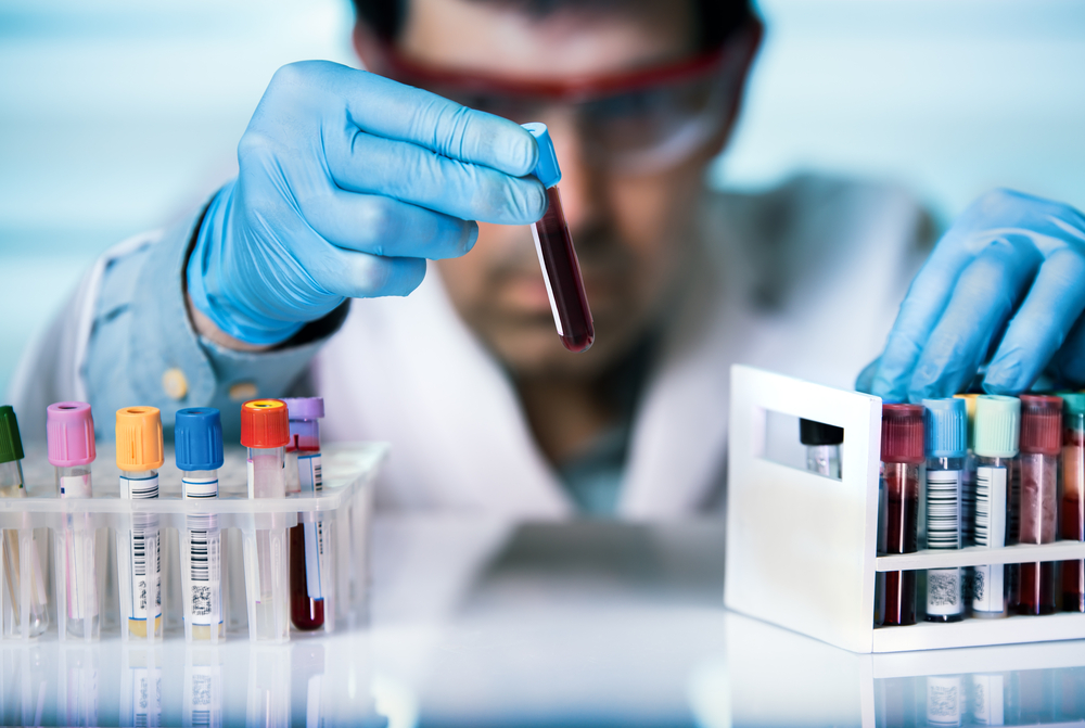 University of Miami to Pay $22 Million to Settle Claims Involving Medically Unnecessary Laboratory Tests and Fraudulent Billing Practices