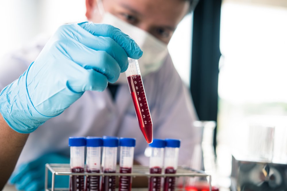 Co-owner of Clinical Lab Admits to Fraudulently Billing Federal, Private Insurance